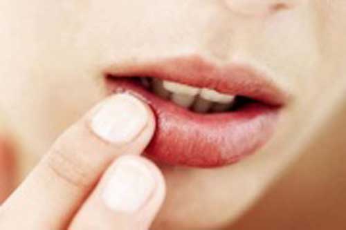 Những cách đơn giản 'cứu' đôi môi không bị nứt nẻ vào mùa đông