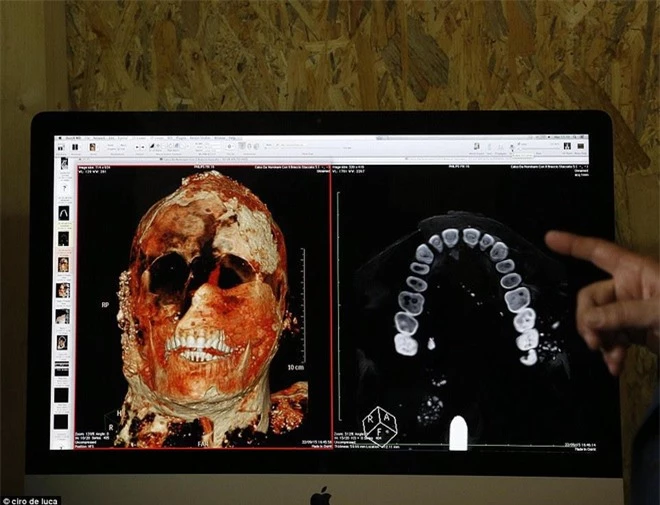 Chụp CT thi thể ‘hóa đá’ của nạn nhân thảm họa Pompeii: ‘Cái chết của họ quá khủng khiếp’ - Ảnh 6.