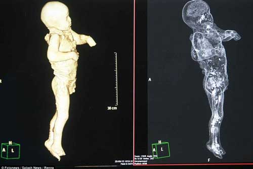 Chụp CT thi thể ‘hóa đá’ của nạn nhân thảm họa Pompeii: ‘Cái chết của họ quá khủng khiếp’