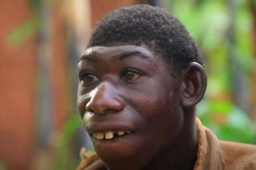 Cuộc sống kỳ lạ của 'Tarzan đời thực': Không có khả năng nhận thức, chỉ biết cắm đầu chạy khắp rừng xanh và bị trêu chọc vì ngoại hình