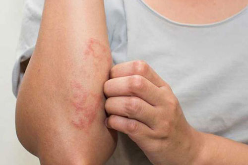 Những bộ phận trên cơ thể bị ngứa nên đi khám sớm, cẩn thận có thể là ung thư