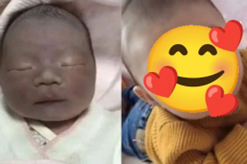 Mẹ bỉm sữa rơi vào trầm tư vì con sinh ra vừa đen vừa xấu, vài tháng sau đứa trẻ 'lột xác' ngoạn mục