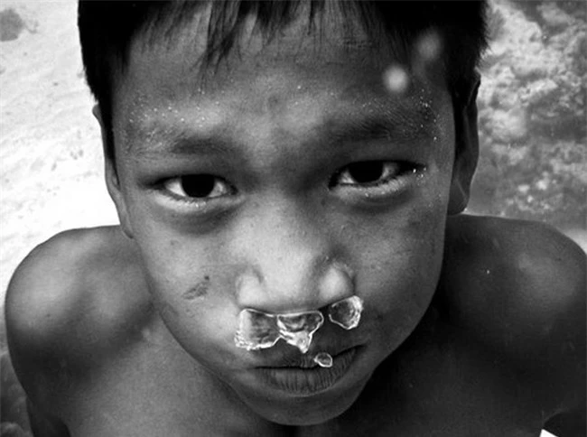 Trẻ em tộc "người cá" bí ẩn ở Thái - 9