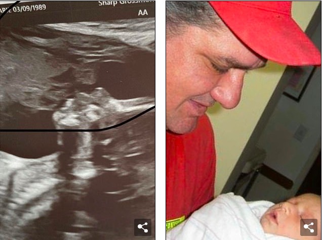 Mẹ bầu sửng sốt khi thấy 'hồn ma' trong ảnh siêu âm thai