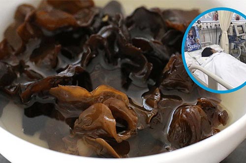 Ăn mộc nhĩ cần biết điều này, đừng dại mà mắc phải