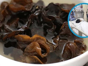 Ăn mộc nhĩ cần biết điều này, đừng dại mà mắc phải