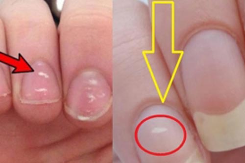 5 bộ phận này chuyển sang màu trắng cảnh báo cơ thể 'xuống cấp' trầm trọng