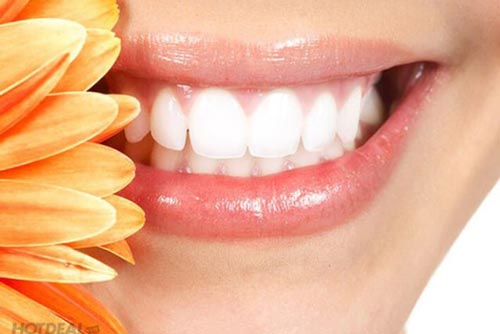 Làm sạch cao răng hiệu quả tại nhà