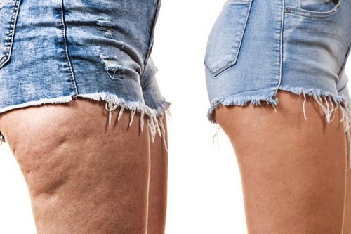 4 lợi ích vàng collagen mang lại cho sức khỏe và sắc đẹp phái nữ