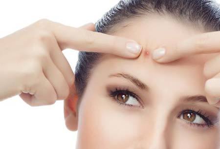 Cách loại bỏ mụn tốt nhất mà không gây hỏng da