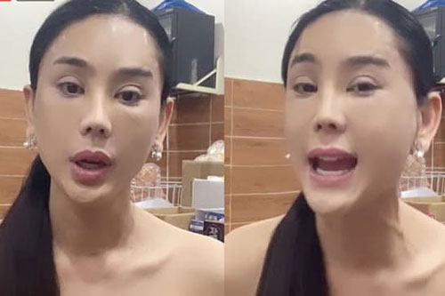 Lâm Khánh Chi gây hoang mang với mặt cứng đơ và mí mắt sưng to khác lạ