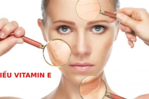 6 dấu hiệu cảnh báo cơ thể thiếu vitamin E, phụ nữ gặp phải tình trạng này sẽ rất nhanh già