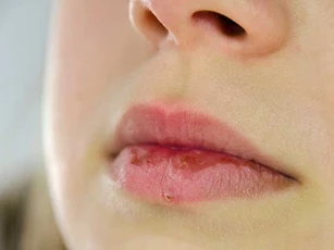 9 dấu hiệu cảnh báo cơ thể đang thiếu chất dinh dưỡng mà nhiều người bỏ qua