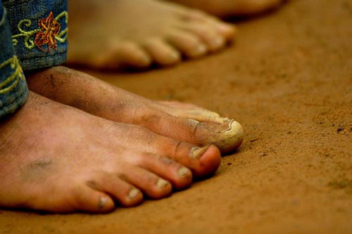 Lý do đáng sợ cần bỏ ngay thói quen đi chân đất thường xuyên