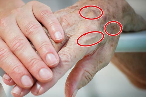 7 bộ phận bên ngoài cơ thể tiết lộ tuổi thật