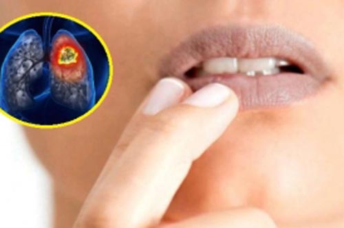 3 dấu hiệu trên mặt cảnh báo phổi đang bị tàn phá nghiêm trọng, chớ dại coi thường