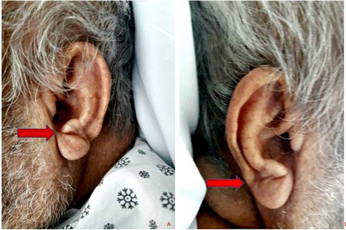 3 bất thường ở tai cho thấy cơ thể đang 'kêu cứu', số 1 cực kỳ nguy hiểm