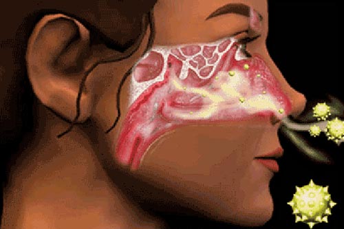 Tác hại khôn lường từ thói quen ngoáy mũi