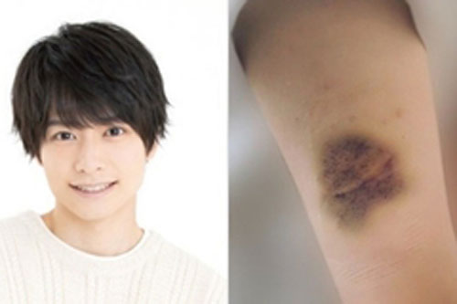 Tài tử Nhật Bản hành hung bạn gái khiến cảnh sát phải can thiệp