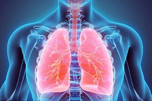 Bệnh phổi ảnh hưởng nhiều đến cuộc sống.