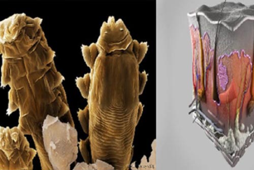 Bí ẩn loài vật '8 chân' sống trên mặt người mà không thể 'tiêu diệt'