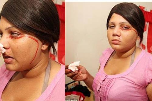 Lý giải đáng sợ chứng bệnh lạ ‘đổ mồ hôi máu’ khiến nhà khoa học đau đầu