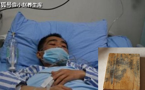 Dùng thớt gỗ 10 năm không thay, 2 cha con bị ung thư gan