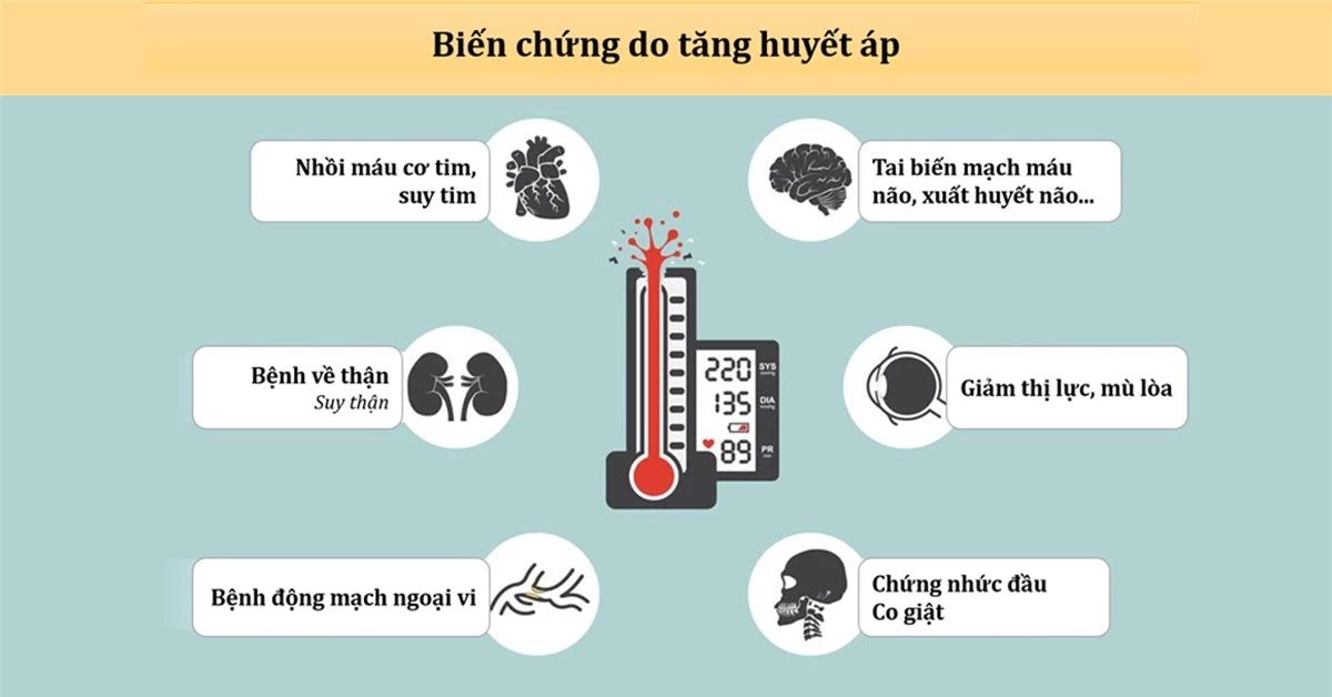 8/10 người bị đột quỵ đều bị tăng huyết áp, bác sĩ chỉ cách kiểm soát vào mùa Đông - Ảnh 3.