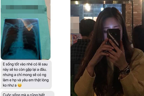 Yêu 5 năm, lúc muốn chia tay chàng trai bịa chuyện có khối u trong người để cắt đuôi, ai ngờ bị bạn gái phát hiện