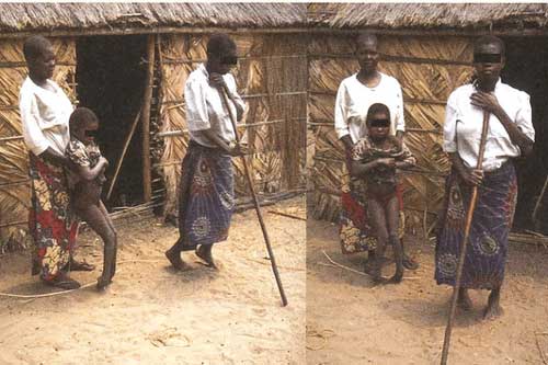 Hàng chục nghìn dân làng bị tê liệt một cách kỳ lạ cùng căn bệnh bí ẩn không liên quan đến vi khuẩn và vi rút đã khiến các chuyên gia phải đau đầu