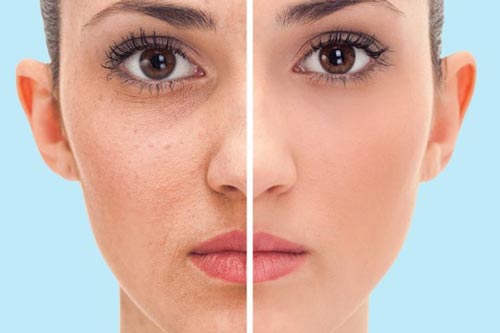 Làm đẹp từ việc tắm nước lạnh vào mùa đông