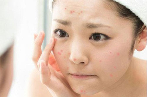 Chị em bị mất cân bằng nội tiết nữ nếu thấy dấu hiệu này