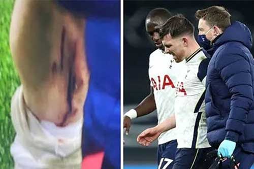 Hojbjerg chấn thương ghê rợn trong ngày Tottenham đánh bại Brentford