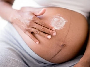Giải mã đường sọc nâu xuất hiện dưới bụng mẹ bầu