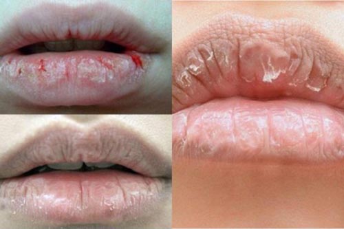 Môi mềm, căng mọng bất chấp thời tiết