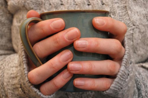 5 điều người bị tiểu đường cần làm trong mùa Đông