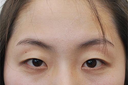 Sai lầm khiến lông mi nhanh gãy rụng