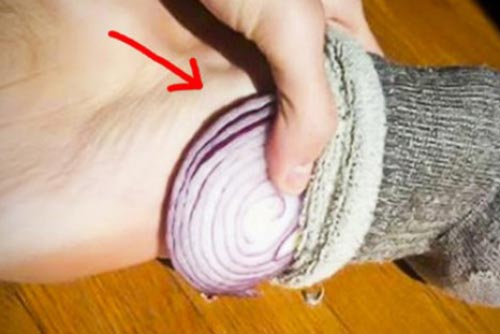 Đắp hành tây vào chân trước khi ngủ bạn sẽ thấy điều "thần kỳ"