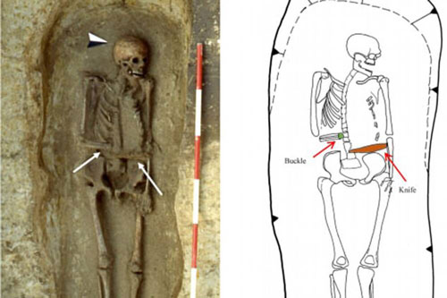 Bí ẩn bộ xương chiến binh kỳ lạ với cánh tay được thay thế bằng một con dao