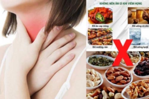 Viêm họng nên ăn gì và kiêng gì để sớm khỏi bệnh?