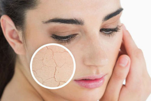 Khắc phục tình trạng da khô vô cùng hiệu quả