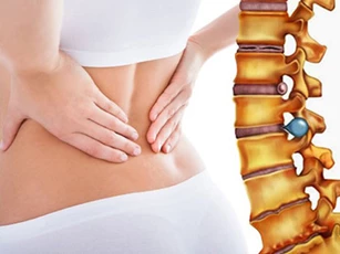 3 dấu hiệu cảnh báo bạn bị thoát vị đĩa đệm