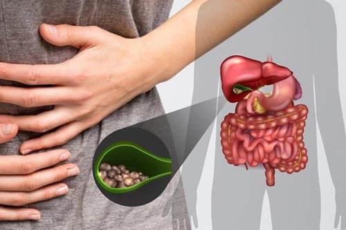 Chế độ ăn cho người bị sỏi mật