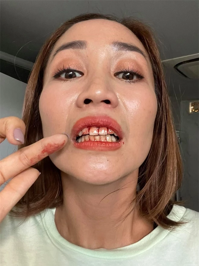 Ốc Thanh Vân bị mẻ răng, Mạc Văn Khoa suýt chết vì đóng cảnh hành động phim Lật Mặt: 48h - Ảnh 3.