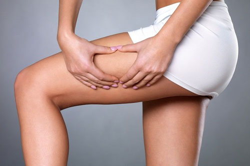 Rạn da và cách ngăn ngừa hiệu quả