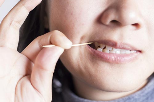 5 thói quen bạn đang tự hủy hoại hàm răng của mình