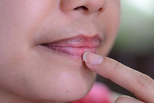 Xử lý môi thâm chỉ với 4 bước đơn giản