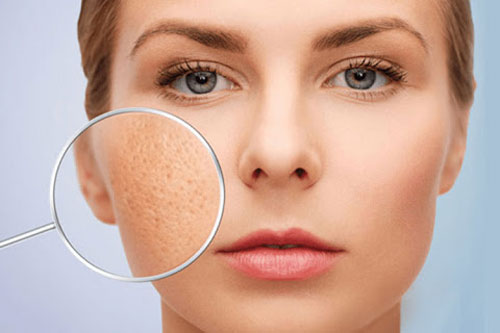 4 cách khắc phục tình trạng lỗ chân lông to, giúp da sáng mịn, tự tin đón Tết