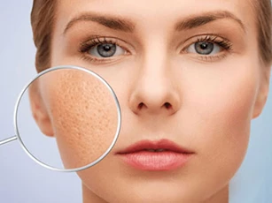 4 cách khắc phục tình trạng lỗ chân lông to, giúp da sáng mịn, tự tin đón Tết