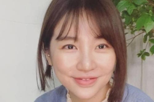 'Thái tử phi' Yoon Eun Hye khiến dân mạng hú hồn khi cười, lộ dấu hiệu phẫu thuật thẩm mỹ rõ mồn một